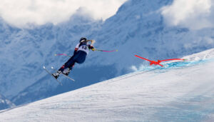 Bericht: Vonn erneut am Bein operiert